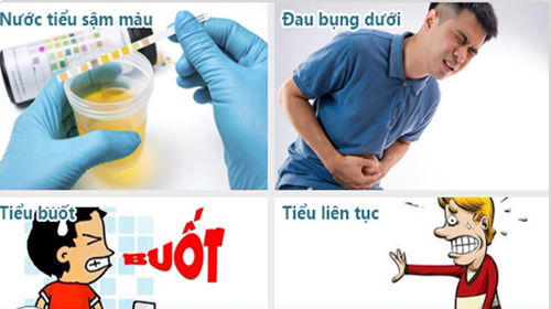Tiểu đau tiểu ra máu là cảnh báo bệnh gì?