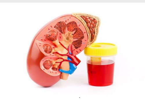 Tiểu Đau Tiểu Ra Máu Là Cảnh Báo Bệnh Gì?