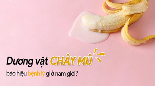 Dương vật bị chảy mủ là dấu hiệu bệnh gì?