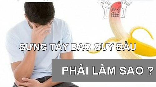 Sưng Tấy Bao Quy Đầu: Đừng Bỏ Qua Các Triệu Chứng Nghiêm Trọng!