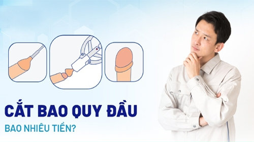 Giá cắt bao quy đầu là bao nhiêu? Những thắc mắc thường gặp