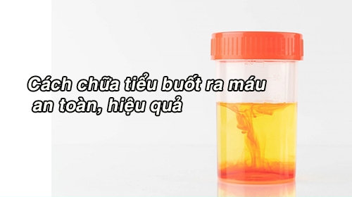 Cách chữa tiểu buốt ra máu an toàn mà hiệu quả
