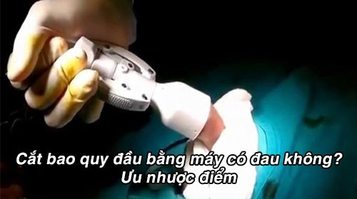 Cắt bao quy đầu bằng máy có đau không? Ưu nhược điểm