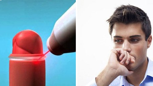 Cắt bao quy đầu bằng laser có an toàn không? Quy trình như thế nào?