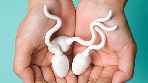 Cách chữa tinh trùng vón cục – Giải pháp sức khoẻ sinh sản nam giới