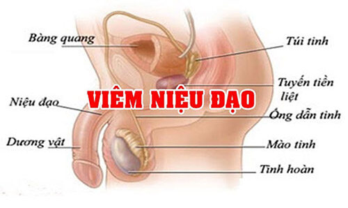 Bệnh viêm niệu đạo ở nam giới có nguy hiểm không?