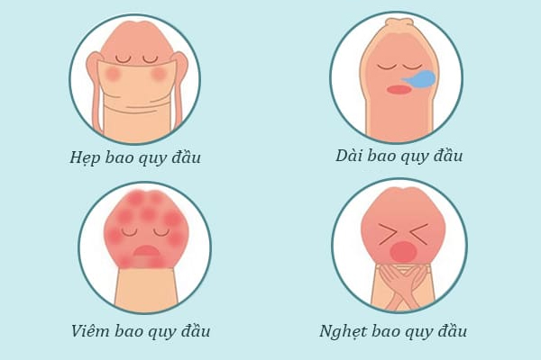 Bệnh viện cắt bao quy đầu tại Đắk Lắk