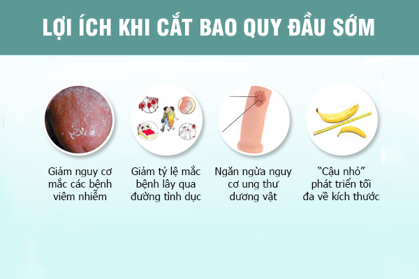 Bệnh viện cắt bao quy đầu tại Đắk Lắk