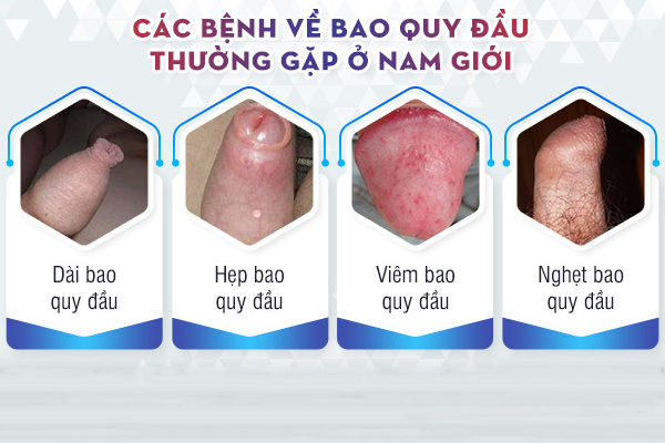 Bệnh viện chuyên khám bao quy đầu tại Đắk Lắk