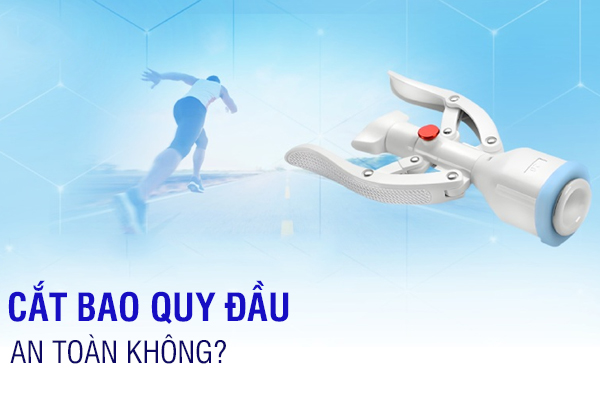 Phẫu thuật cắt bao quy đầu an toàn không?