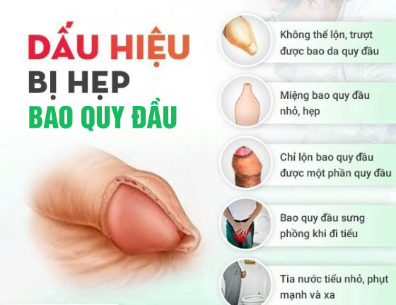 05 DẤU HIỆU HẸP BAO QUY ĐẦU NAM GIỚI CẦN ĐI KHÁM NGAY